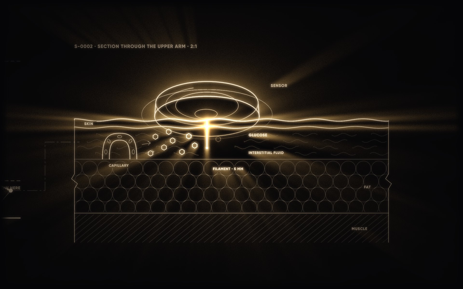 A section through the upper arm: the sensor, its filament five millimetres down, lit in amber